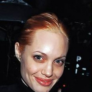 Анджелина Джоли до и после пластики