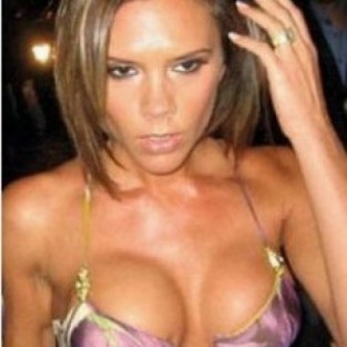 Виктория Бекхэм: увеличение груди