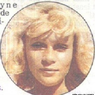 Жаклин Вайлдштейн после многочисленной пластики