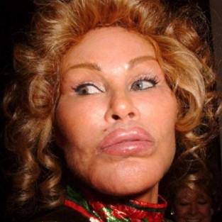 До пластической операции и после Jocelyn Wildenste